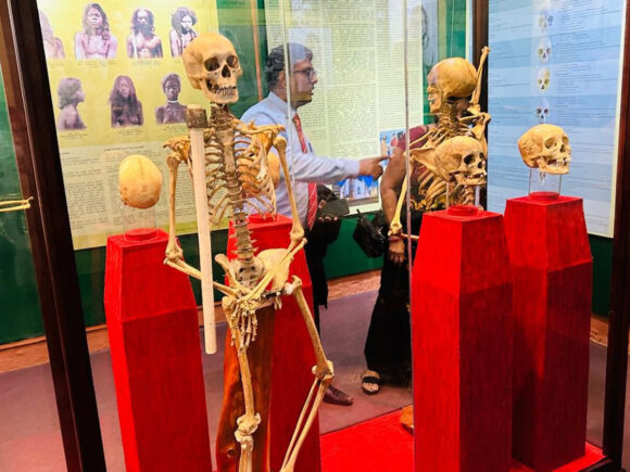 Preservation of Repatriated Indigenous Human Skeletal Remains of Sri Lankans